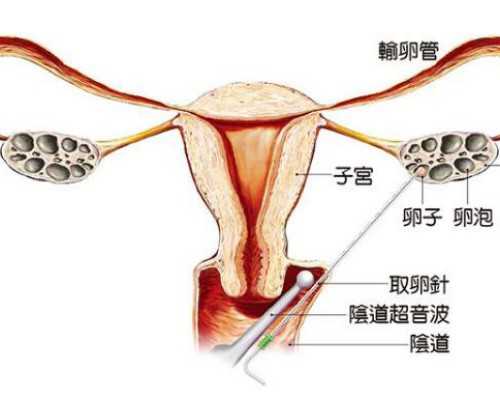 武汉国际医学中心生殖中心试点推出“试管婴儿+保险”HMO模式