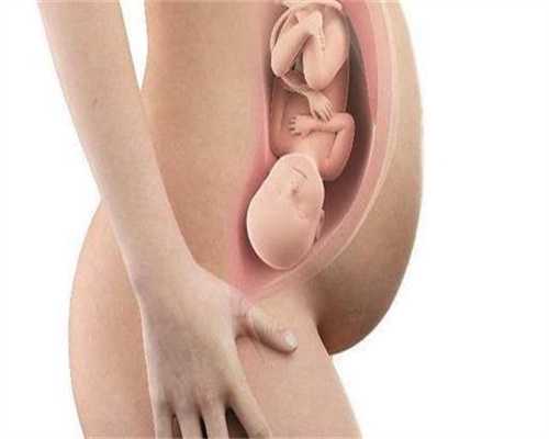 代孕初期乳房有哪些症状和变化，乳房会变大吗