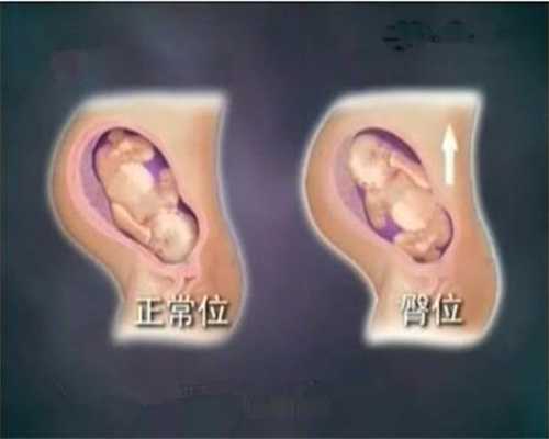 武汉代孕哪里最便宜：处理不好母子都有生命危