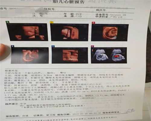 广州皇家试管婴儿_代孕的前兆 看你是否已经代孕