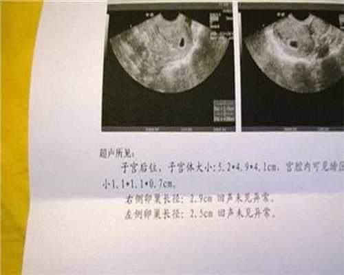 武汉代孕医院那家伙_武汉代孕的龙凤胎_上海辅助生育机构：有卵泡不排卵的原