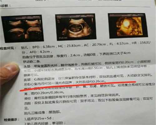 武汉哪里的医院可以助孕_武汉哪些国家助孕合法呢_扭转卵巢卵巢囊肿怎么办
