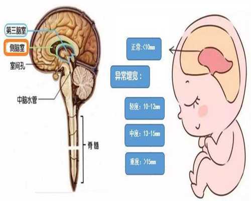 武汉代孕需要做好哪些准备_武汉关于代孕产子的_代孕套餐：昆明南方39医院试