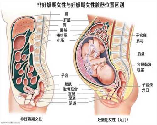 武汉哪里有助孕的呀_武汉助孕成功率多少的_代孕血流的是谁的_正规的代孕网