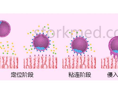 南宁试管助孕费用解析:二代试管性别选择与泰国捐卵流程