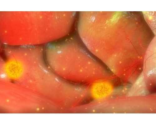 解析广西本地辅助生殖技术与费用：揭秘试管婴儿周期