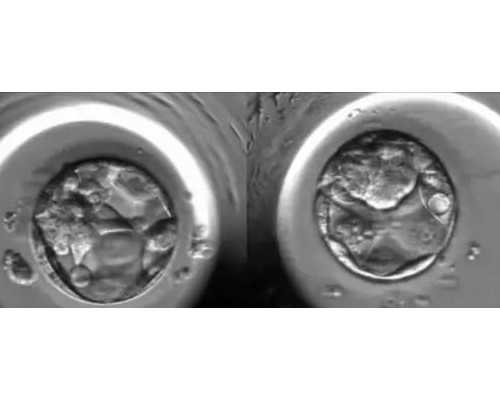 辅助生殖技术：安全可靠的生育解决方案