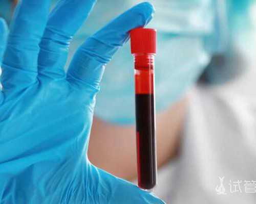 42岁高龄备孕:南宁试管助孕41岁、42岁、54岁女性做试管婴儿的可能性分析